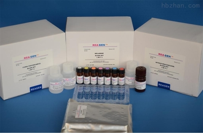 人淀粉酶(Amylase)ELISA試劑盒 精準檢測的得力工具——以上海萬疆生物技術產品為例